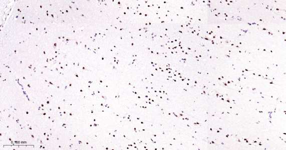 Tar DNA 结合蛋白43即用型免疫组化试剂盒-IHC0429